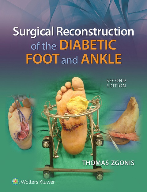 Cover image for book Surgical Reconstruction of the Diabetic Foot and Ankle