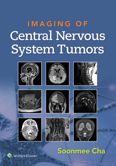 Cover image for book Imaging of Central Nervous System Tumors