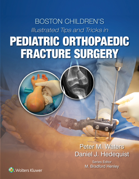 Cover image for book Boston Children’s Illustrated Tips and Tricks in Pediatric Orthopaedic Fracture Surgery