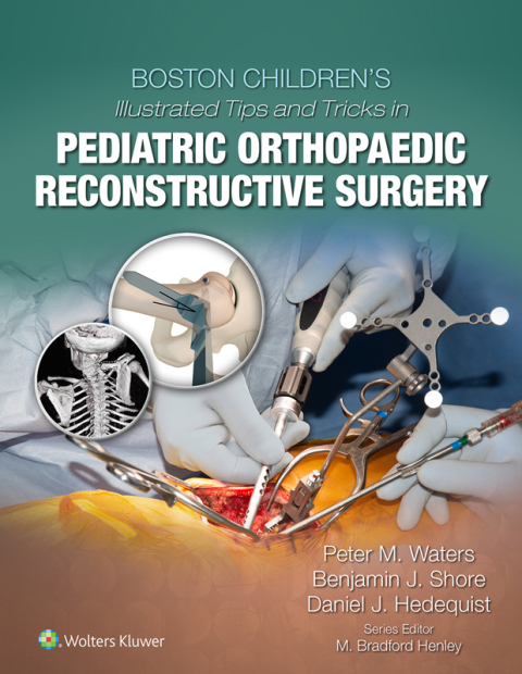 Cover image for book Boston Children's Illustrated Tips and Tricks in Pediatric Orthopaedic Reconstructive Surgery