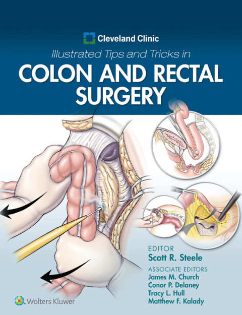 Cover image for book Cleveland Clinic Illustrated Tips and Tricks in Colon and Rectal Surgery