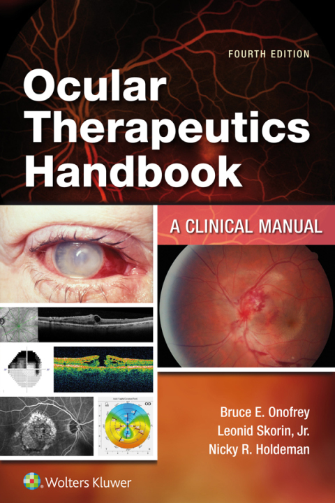 Cover image for book Ocular Therapeutics Handbook