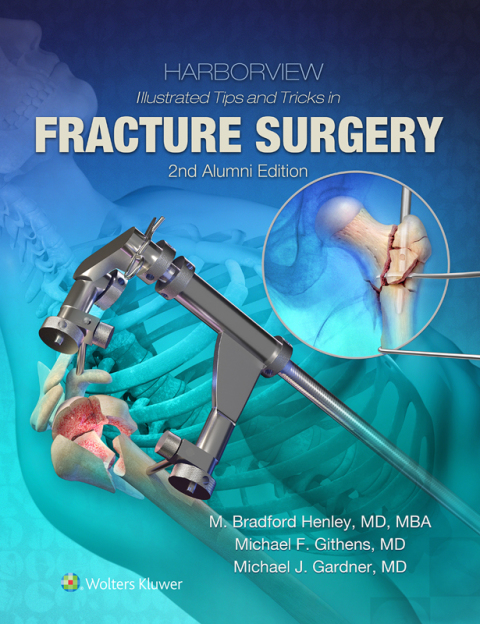 Cover image for book Harborview Illustrated Tips and Tricks in Fracture Surgery