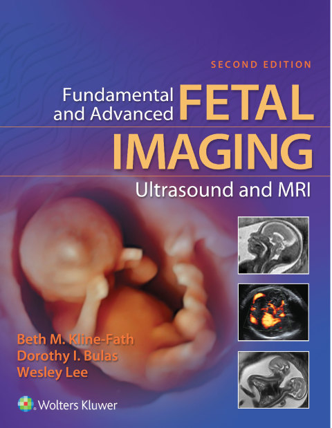 Cover image for book Fundamental and Advanced Fetal Imaging Ultrasound and MRI