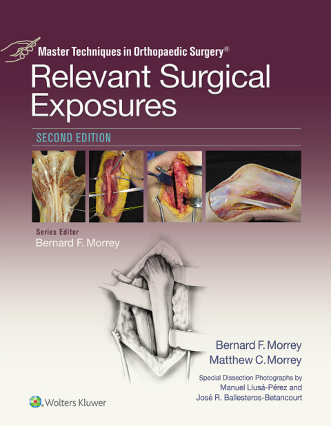Cover image for book Master Techniques in Orthopaedic Surgery: Relevant Surgical Exposures