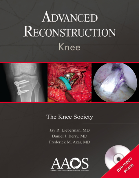 Cover image for book Advanced Reconstruction: Knee