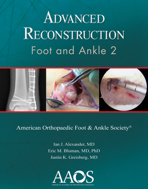 Cover image for book Advanced Reconstruction: Foot and Ankle 2