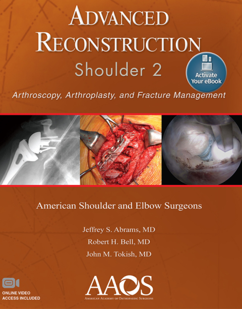 Cover image for book Advanced Reconstruction: Shoulder 2