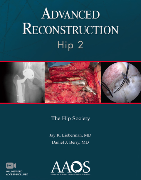 Cover image for book Advanced Reconstruction: Hip 2