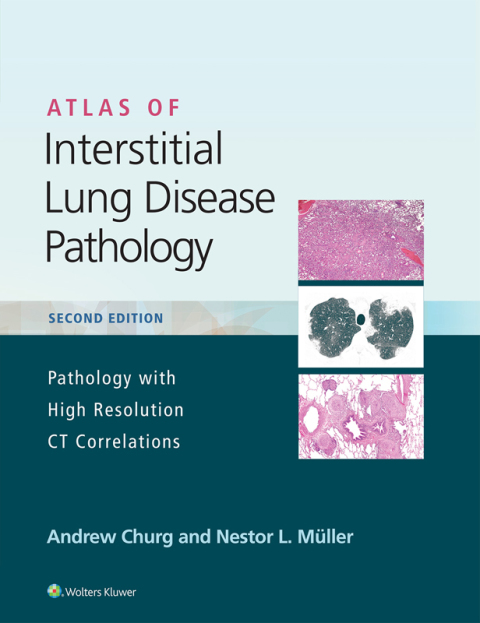 Cover image for book Atlas of Interstitial Lung Disease Pathology