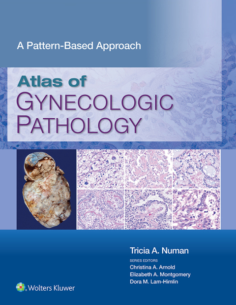 Cover image for book Atlas of Gynecologic Pathology