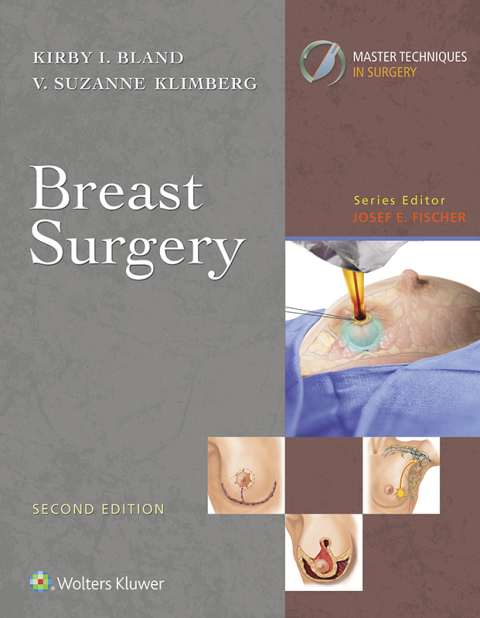 Cover image for book Master Techniques in Surgery: Breast Surgery
