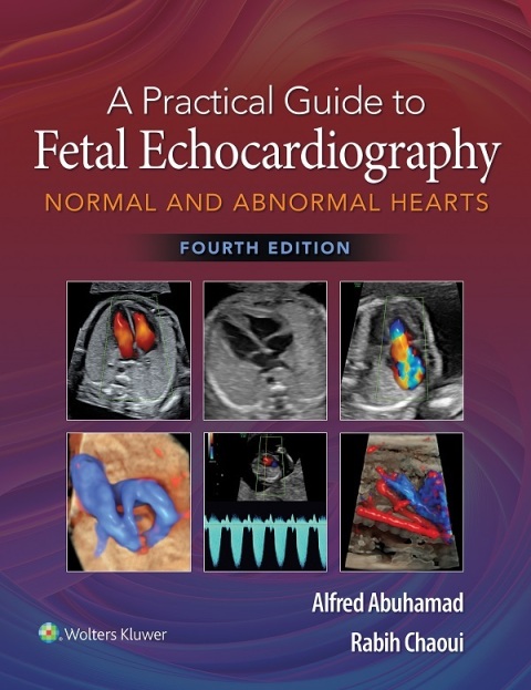 Cover image for book A Practical Guide to Fetal Echocardiography