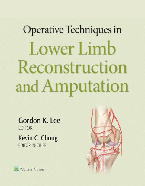 Cover image for book Operative Techniques in Lower Limb Reconstruction and Amputation