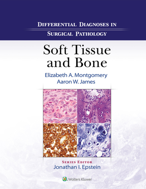Cover image for book Differential Diagnoses in Surgical Pathology: Soft Tissue and Bone