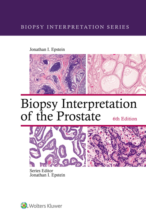 Cover image for book Biopsy Interpretation of the Prostate