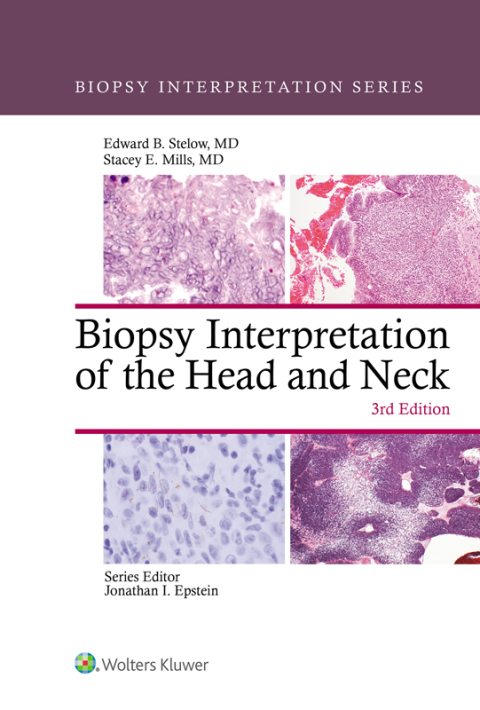 Cover image for book Biopsy Interpretation of the Head and Neck
