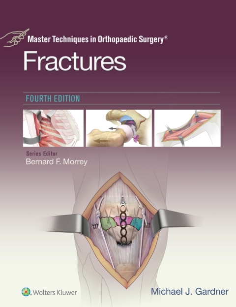 Cover image for book Master Techniques in Orthopaedic Surgery: Fractures