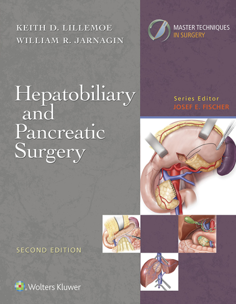 Cover image for book Master Techniques in Surgery: Hepatobiliary and Pancreatic Surgery