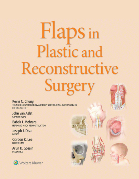 Cover image for book Flaps in Plastic and Reconstructive Surgery