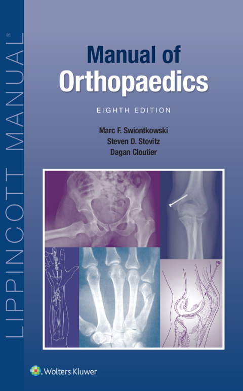 Cover image for book Manual of Orthopaedics