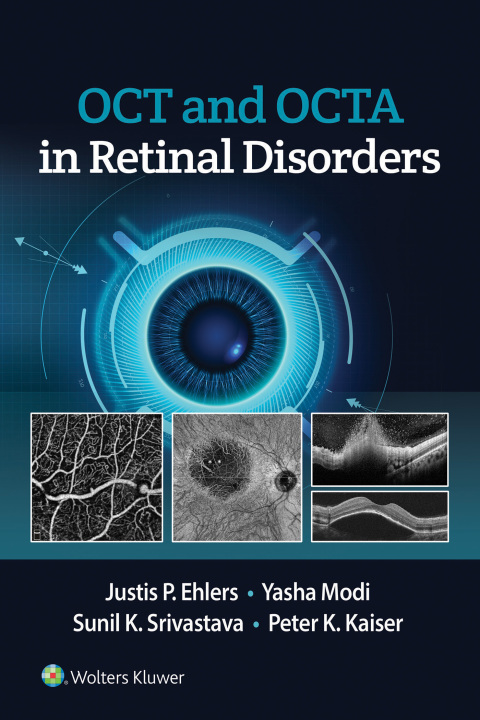 Cover image for book OCT and OCT Angiography in Retinal Disorders