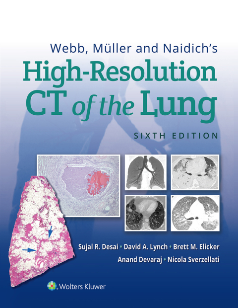 Cover image for book Webb, Müller and Naidich's High-Resolution CT of the Lung