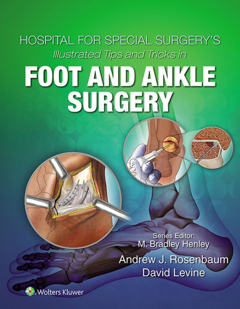 Cover image for book Hospital for Special Surgery's Illustrated Tips and Tricks in Foot and Ankle Surgery