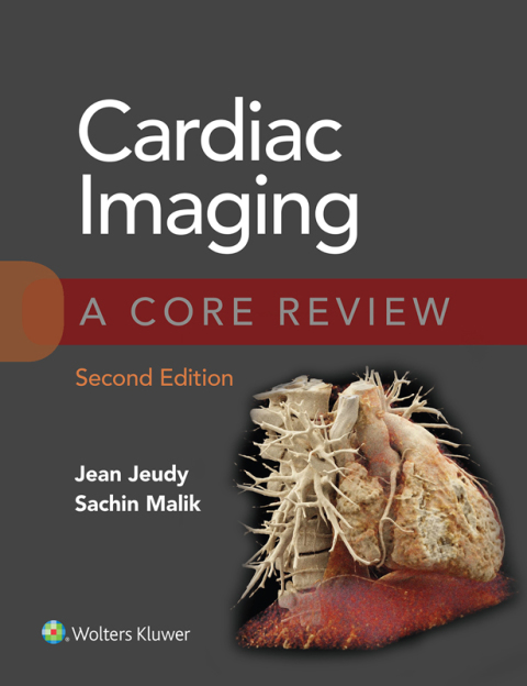 Cover image for book Cardiac Imaging: A Core Review