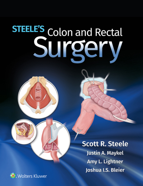 Cover image for book Steele's Colon and Rectal Surgery