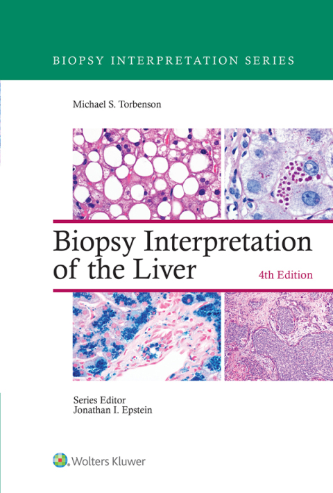 Cover image for book Biopsy Interpretation of the Liver