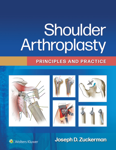 Cover image for book Shoulder Arthroplasty
