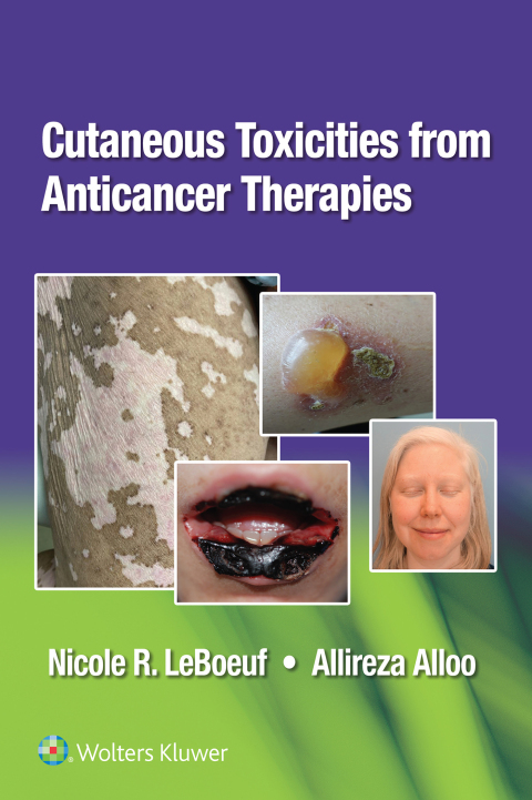 Cover image for book Cutaneous Reactions from Anti-Cancer Therapies