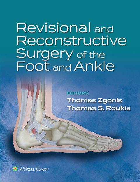 Cover image for book Revisional and Reconstructive Surgery of the Foot and Ankle