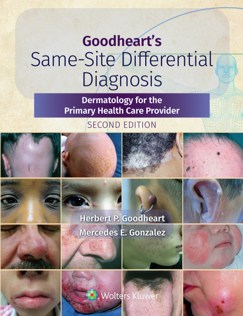 Cover image for book Goodheart's Same-Site Differential Diagnosis