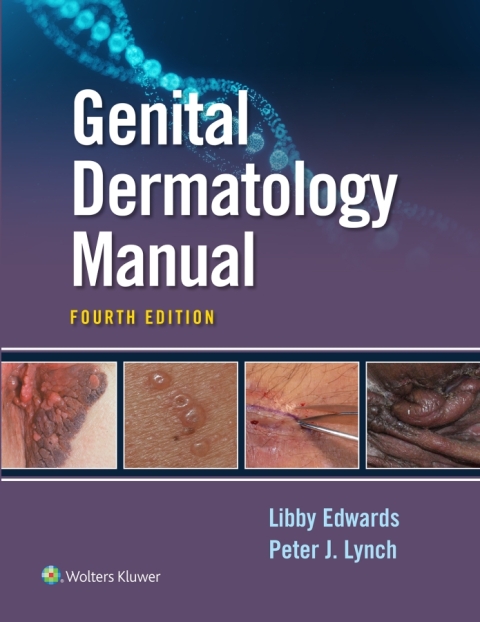 Cover image for book Genital Dermatology Manual
