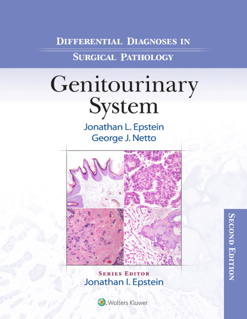 Cover image for book Differential Diagnoses in Surgical Pathology: Genitourinary System