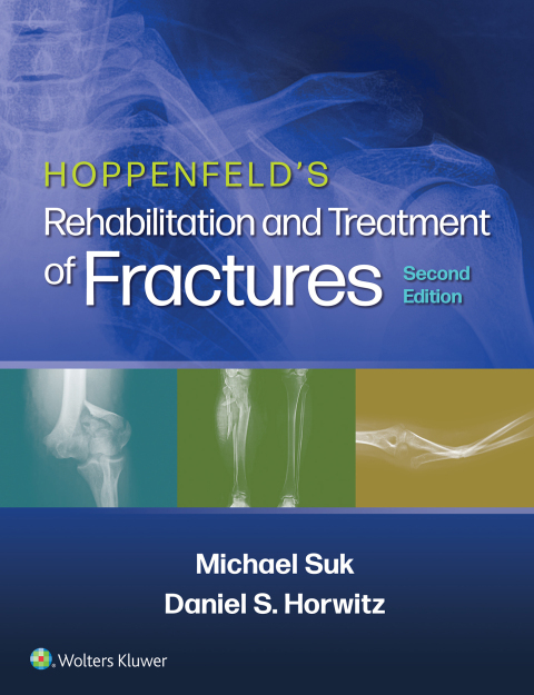 Cover image for book Hoppenfeld's Treatment and Rehabilitation of Fractures