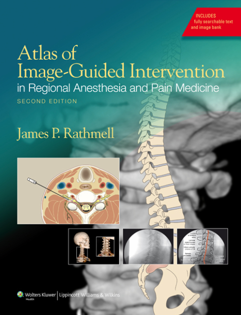Cover image for book Atlas of Image-Guided Intervention in Regional Anesthesia and Pain Medicine