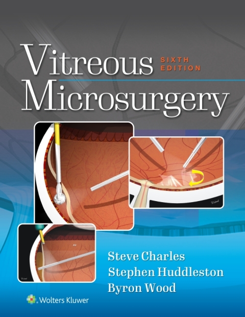 Cover image for book Vitreous Microsurgery