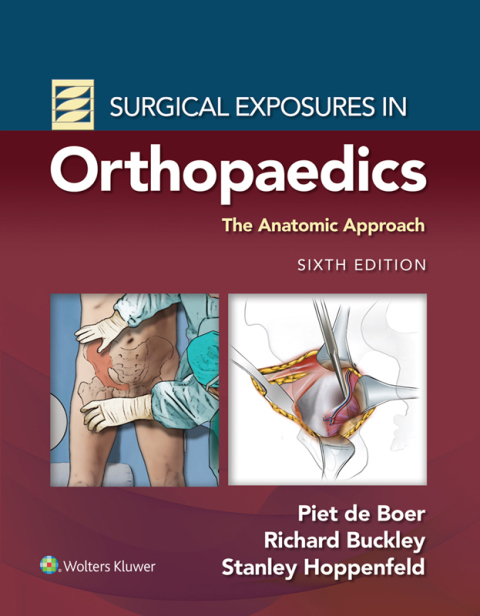 Cover image for book Surgical Exposures in Orthopaedics: The Anatomic Approach
