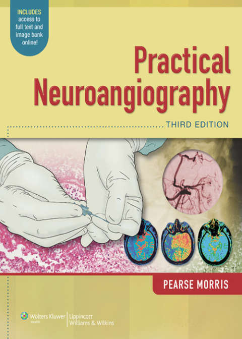 Cover image for book Practical Neuroangiography