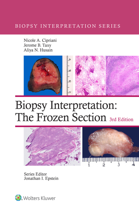 Cover image for book Biopsy Interpretation: The Frozen Section
