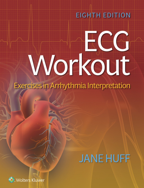 Ecg Workout:Exer.In Arrhythmia W/Access