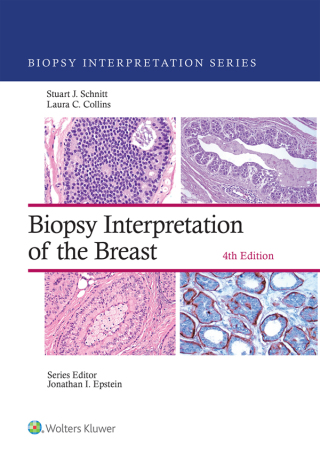Biopsy Interpretation of the Breast