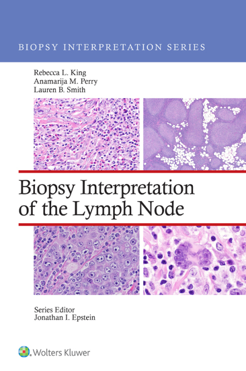 Cover image for book Biopsy Interpretation of the Lymph Nodes