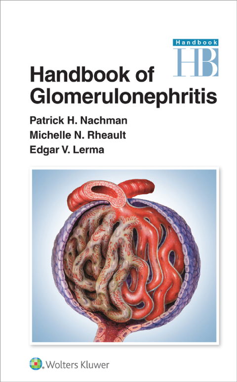 Cover image for book Handbook of Glomerulonephritis