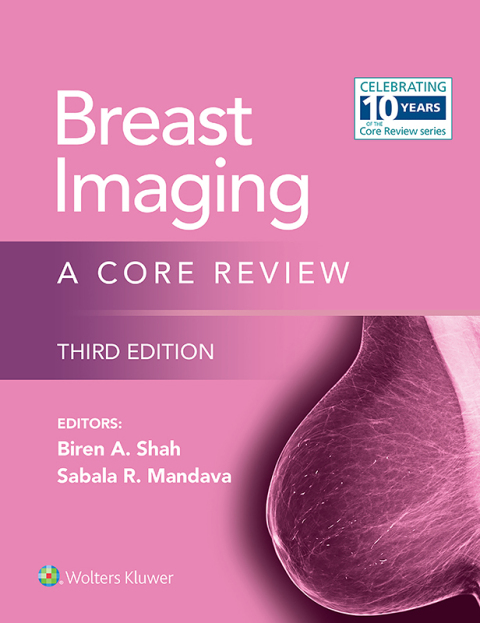 Cover image for book Breast Imaging