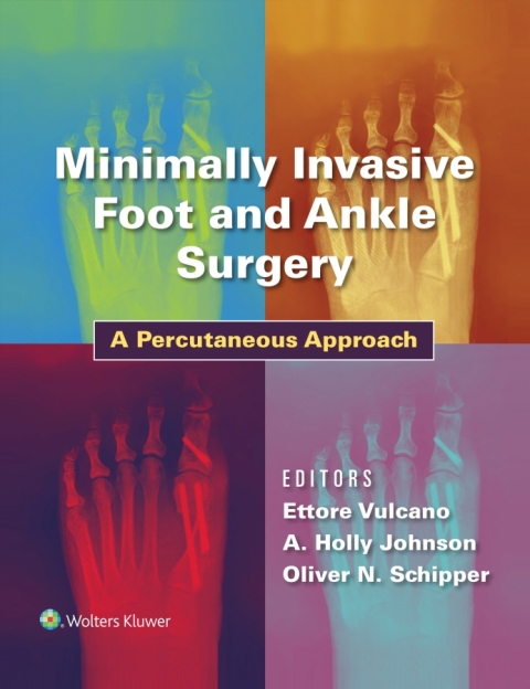 Cover image for book Minimally Invasive Foot and Ankle Surgery
