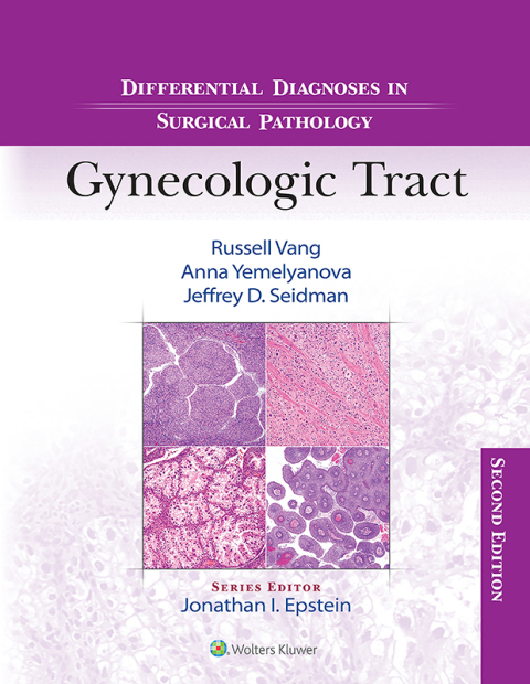Cover image for book Differential Diagnoses in Surgical Pathology: Gynecologic Tract